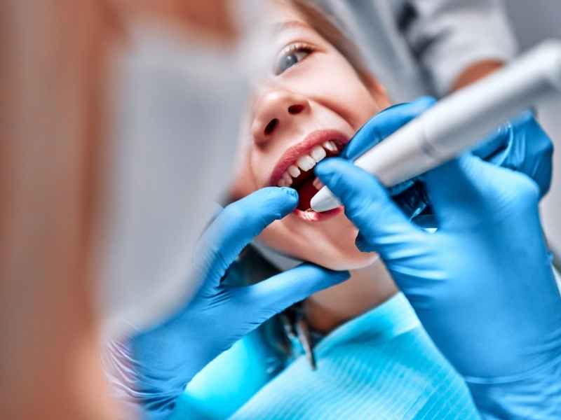 Tahapan Pembersihan Karang Gigi di Dental Clinic BSD